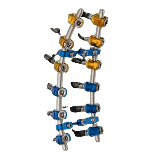 Neoortho - Parafuso Pedicular Neospine