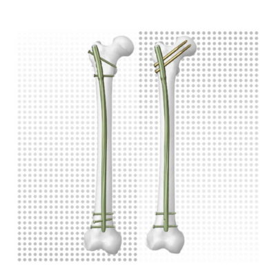 DePuy Synthes - Haste Femoral Lateral EXPERT LFN